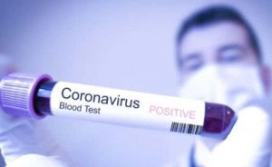 На Сумщині зафіксували перший випадок занедужання на коронавірус