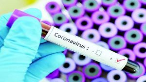Фахівці, які працюють в лабораторіях, зможуть  отримувати доплати за ризики, пов’язані з COVID-19