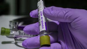Своя лабораторія з виявлення штамів коронавірусу — питання нацбезпеки
