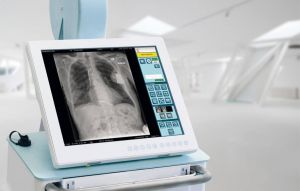 Одещина: Запрацював пересувний рентгенапарат