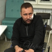 <<Тітушки>> жорстоко побили бійця АТО