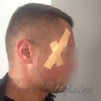 Під час сутички із протестувальниками постраждали восьмеро правоохоронців