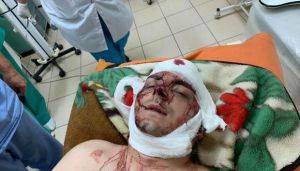 Колишнього міського голову Конотопа намагалися вбити