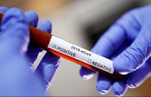 У Києві кількість хворих на коронавірус збільшилася на 28 осіб