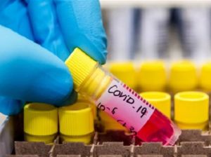 У одеській «Перлинці» — спалах коронавірусу