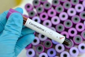 Найбільше інфікувань  підтвердили у столиці