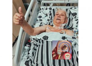 Львів: Операція на серці майже без наркозу