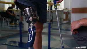 Протезування та реабілітація