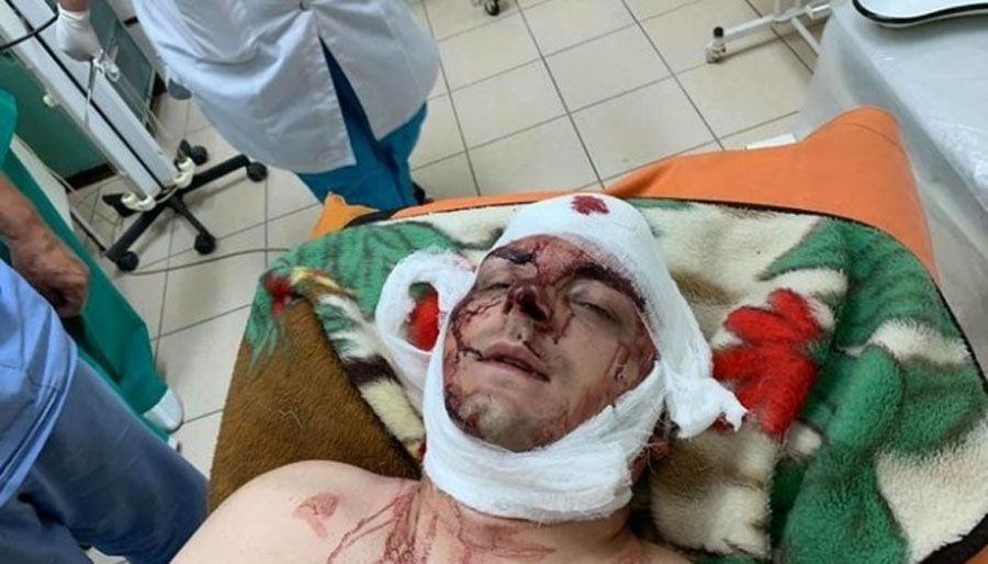 Колишнього міського голову Конотопа намагалися вбити