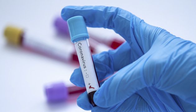 У Чернівцях на COVID-19, на жаль, хворіє багато дітей