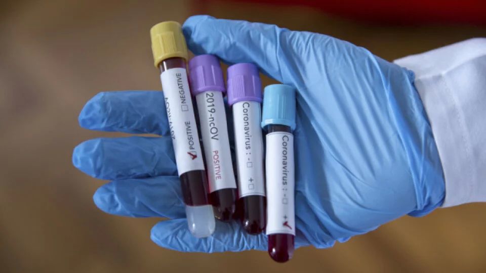 Просять справедливо нарахувати  компенсації сім’ям загиблих медиків